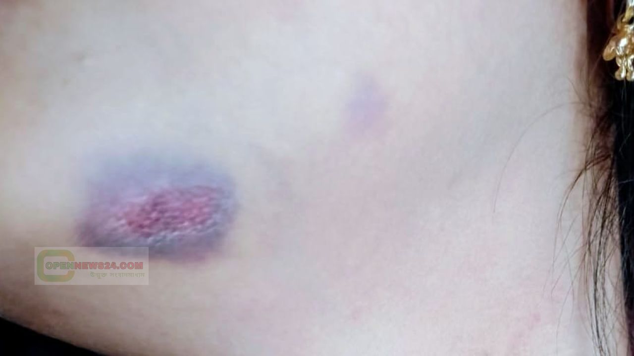 সিরাজদিখানে হামলা ও লুট–নারীসহ ৫ জন আহত