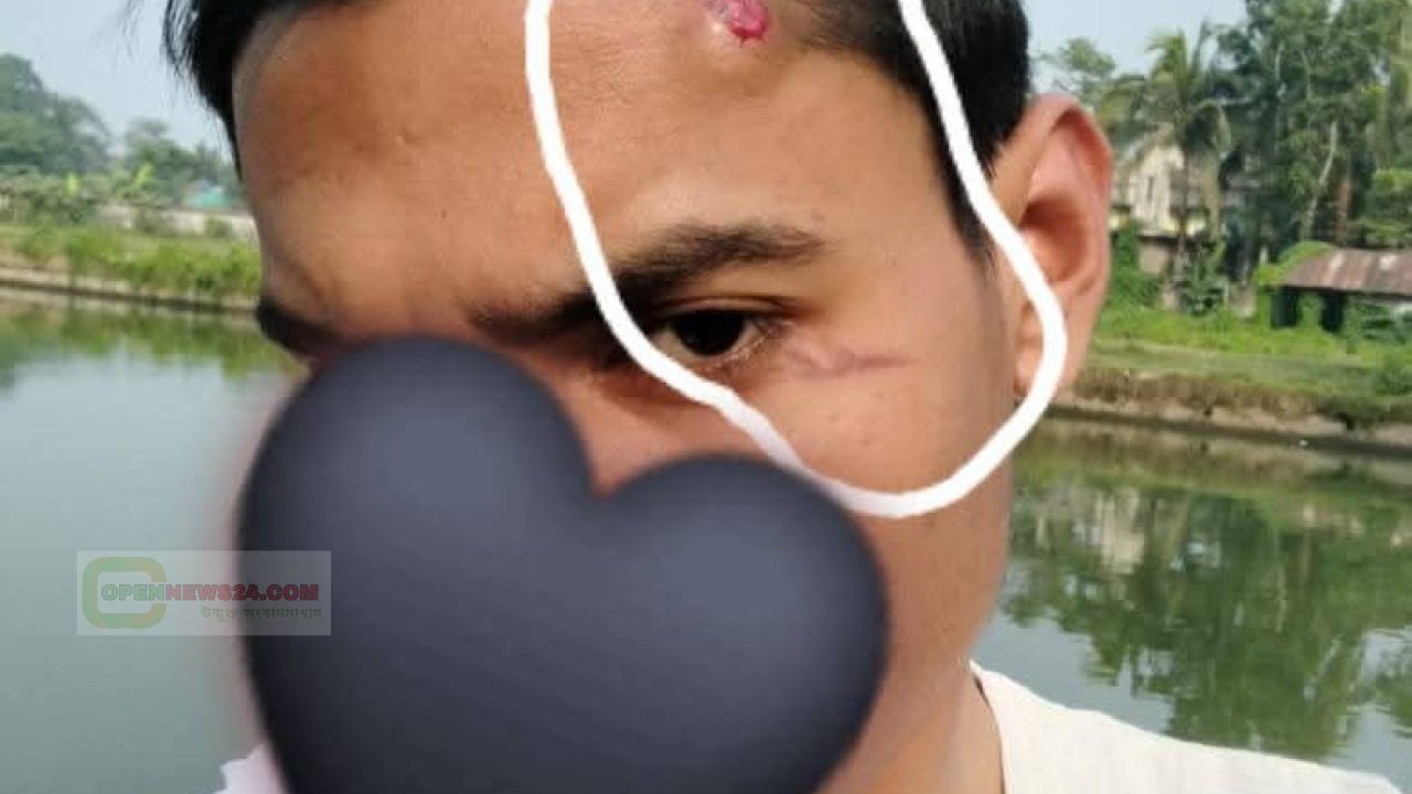 চিওড়া আছগরিয়া ফাজিল ডিগ্রি মাদ্রাসার শৃঙ্খলা ভঙ্গ ও অনিয়ম নিয়ে শিক্ষার্থীদের ক্ষোভ