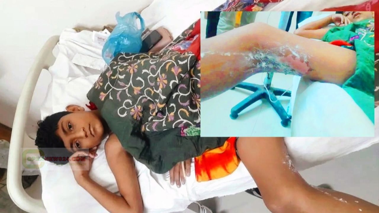 নড়াইলের ছোট কালিয়া মোড়ে বোমা সদৃশ্য বস্তু বিস্ফোরণ, শিশু আহত