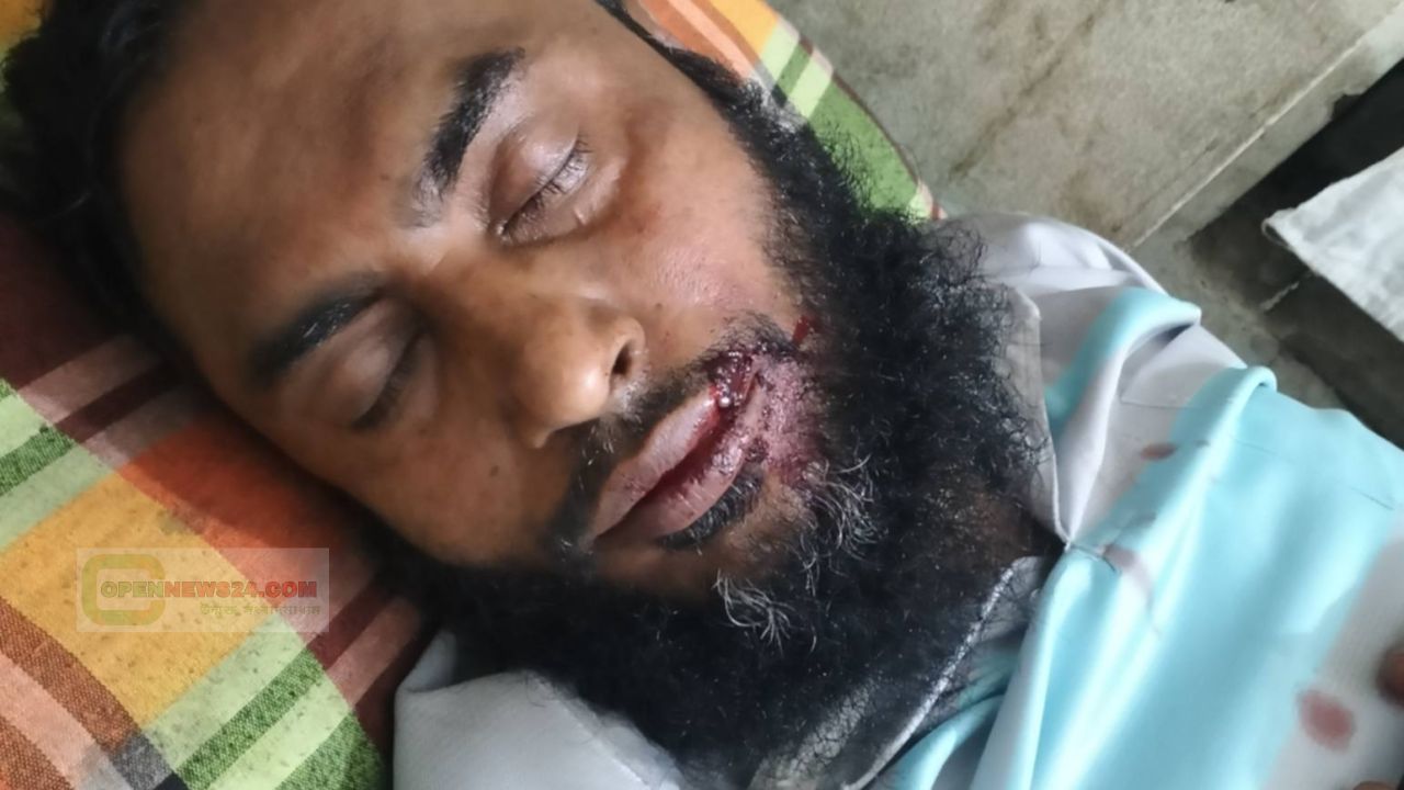 মাদক সেবন এ বাধা হোটেল মালিককে কুপিয়ে জখম করেছে সন্ত্রাসীরা 