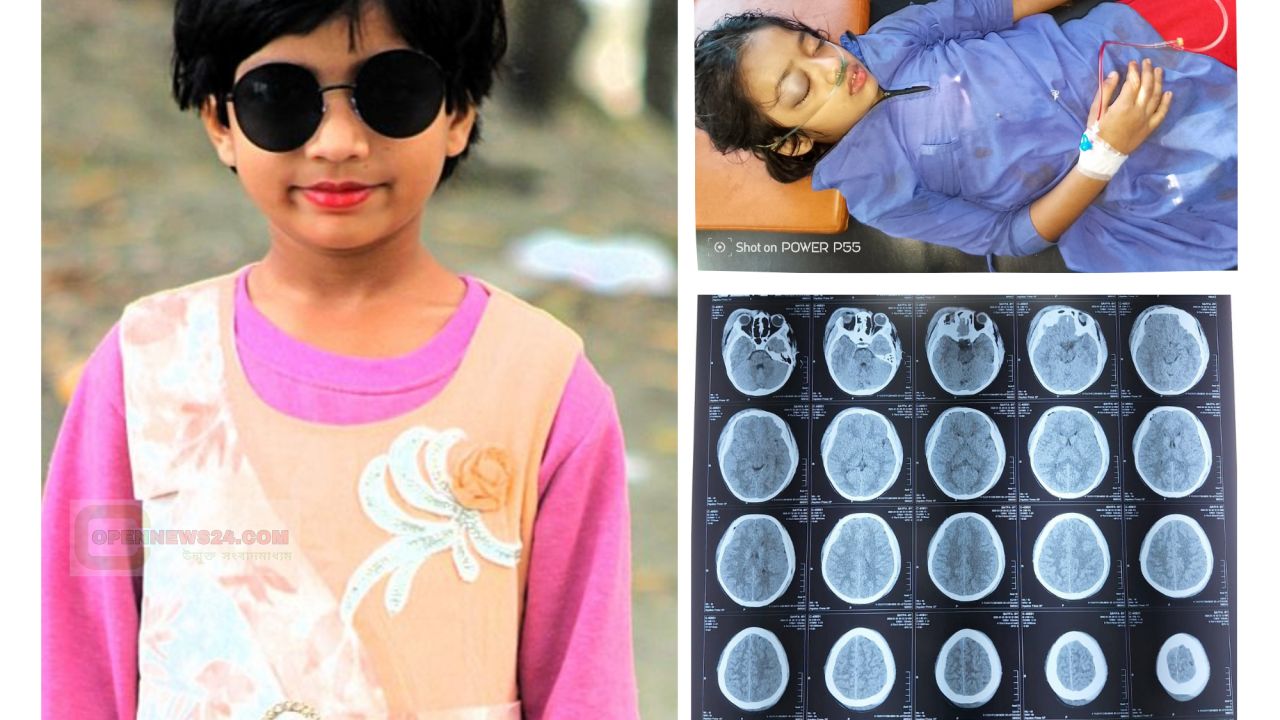 স্কুল ভবন থেকে পড়ে গুরুতর আহত তৃতীয় শ্রেণির শিক্ষার্থী সাইফা আলম  ঢাকায় আইসিইউতে চিকিৎসাধীন, দেশবাসীর কাছে দোয়া কামনা